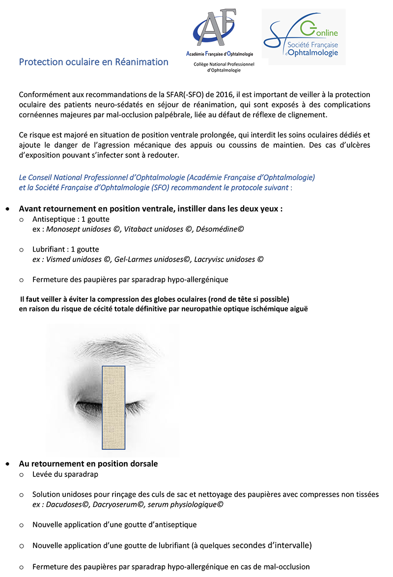 CNP Ophtalmologie